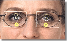 Frontaufnahme mittels Video-Infral® Frontaufnahme mittels Video-Infral®