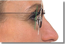 Seitliche Aufnahme mittels Video-Infral® Seitliche Aufnahme mittels Video-Infral®